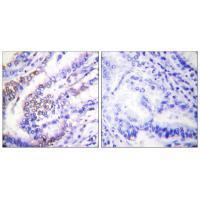 Cyclin E1 Antibody 