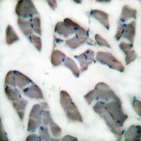 Desmin Antibody