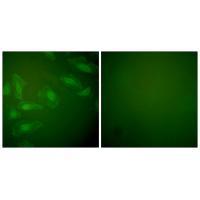 DJ-1 Antibody