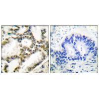 DJ-1 Antibody