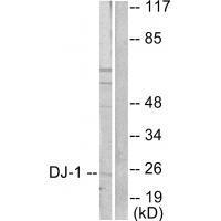 DJ-1 Antibody