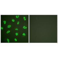 DNA-PK Antibody