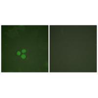 DP-1 Antibody