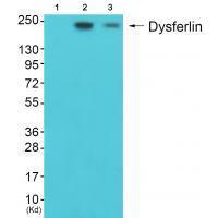 Dysferlin Antibody 