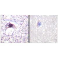 E2F6 Antibody