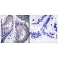 Endostatin Antibody