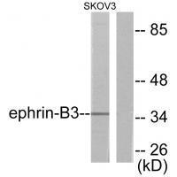 Ephrin-B3 Antibody