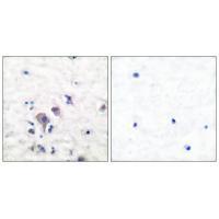 GluR2/3 Antibody