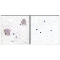GluR4 Antibody