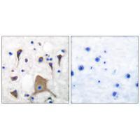 GluR5 Antibody