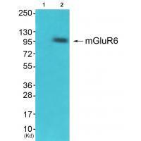 GluR6 Antibody