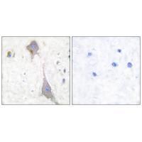 GluR7 Antibody