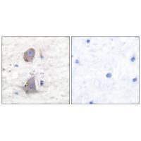 GLUT1 Antibody