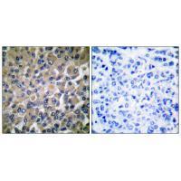 GRP78 Antibody