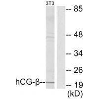 hCG β Antibody