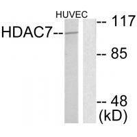HDAC7 Antibody