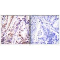 HDAC9 Antibody