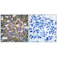 Keratin 15 Antibody