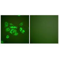 Keratin 10 Antibody