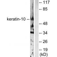 Keratin 10 Antibody
