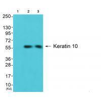 Keratin 10 Antibody