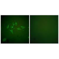 iNOS Antibody