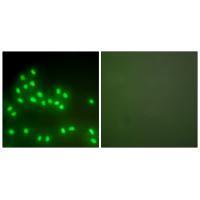 Ku70/80 Antibody