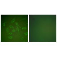 Mammaglobin Antibody