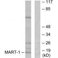 MART-1 Antibody