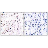 MCM5 Antibody