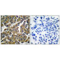MMP-3 Antibody