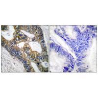 MMP-7 Antibody