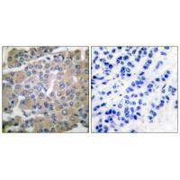 MMP-8 Antibody