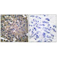 MMP-9 Antibody