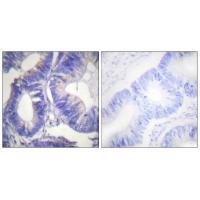 NCK2 Antibody