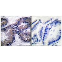NRF2 Antibody