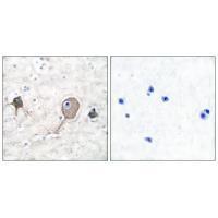 NSE Antibody