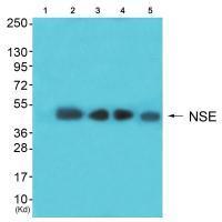 NSE Antibody