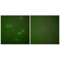 p14 ARF Antibody