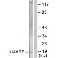 p14 ARF Antibody