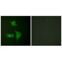 p15 INK Antibody