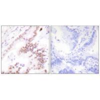 p300 Antibody