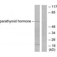 Parathyroid Hormone Antibody