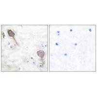 Parkin Antibody