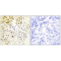 Cyclin-L1 Antibody
