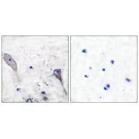 Patched Antibody