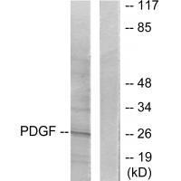 PDGFB Antibody