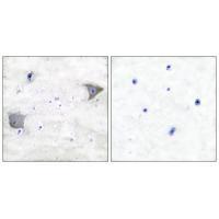 PDGFR α Antibody