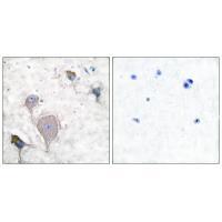 Peripherin Antibody