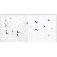 Potassium Channel Kv3.2b Antibody